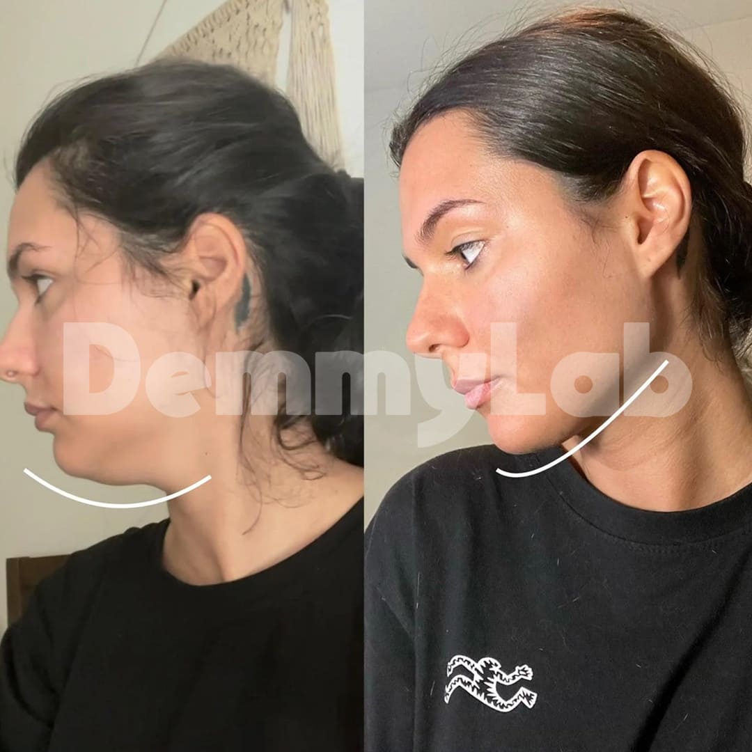 DemmyLab - Spazzola Viso Linfodrenante