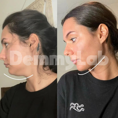 DemmyLab - Spazzola Viso Linfodrenante